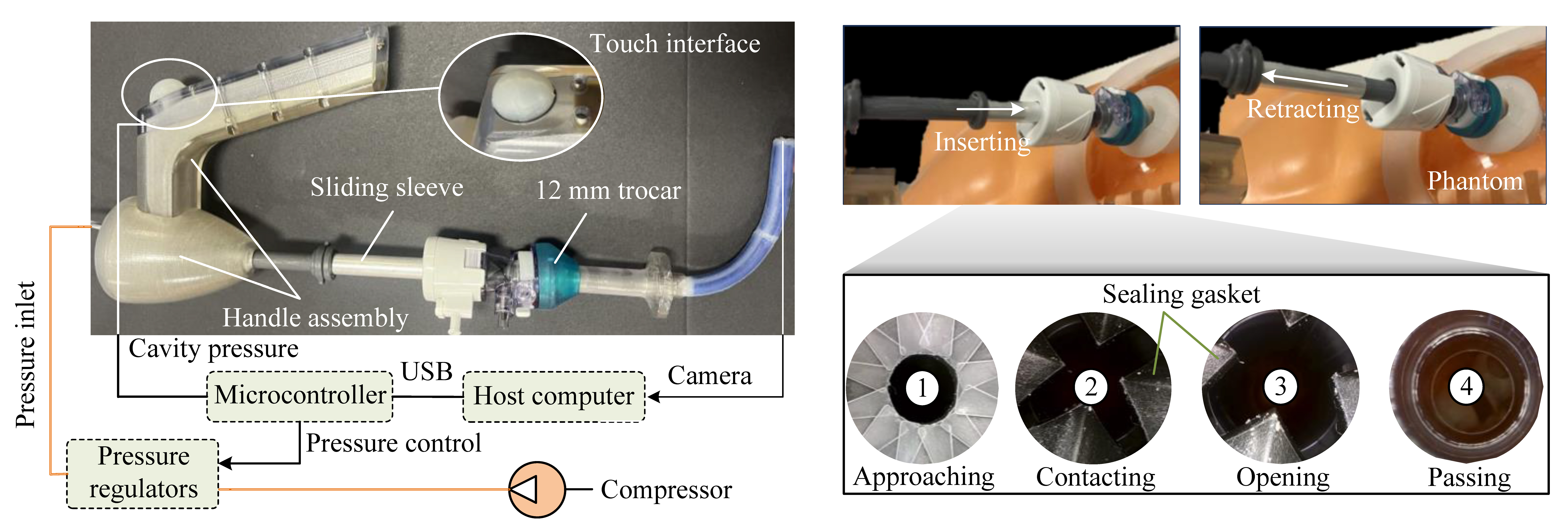 laparoscope image